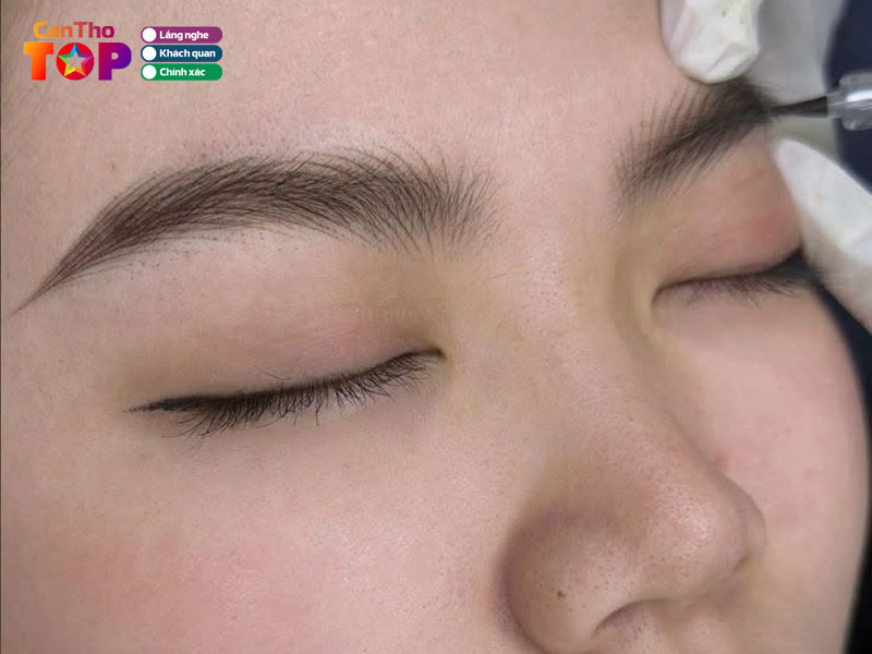 Bich-ngan-brows-canthotoplist