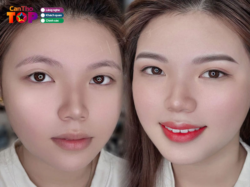 Hoatrang-brows-canthotoplist